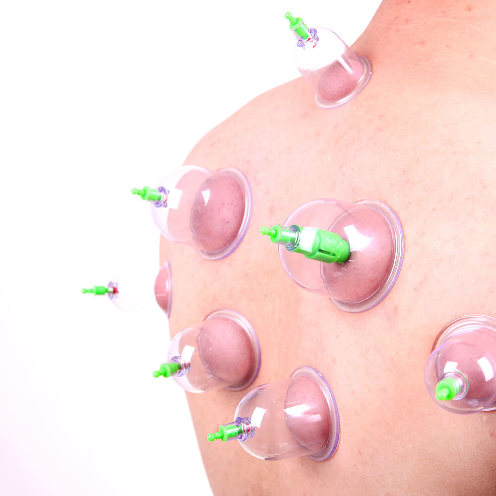 cupping device(图4)