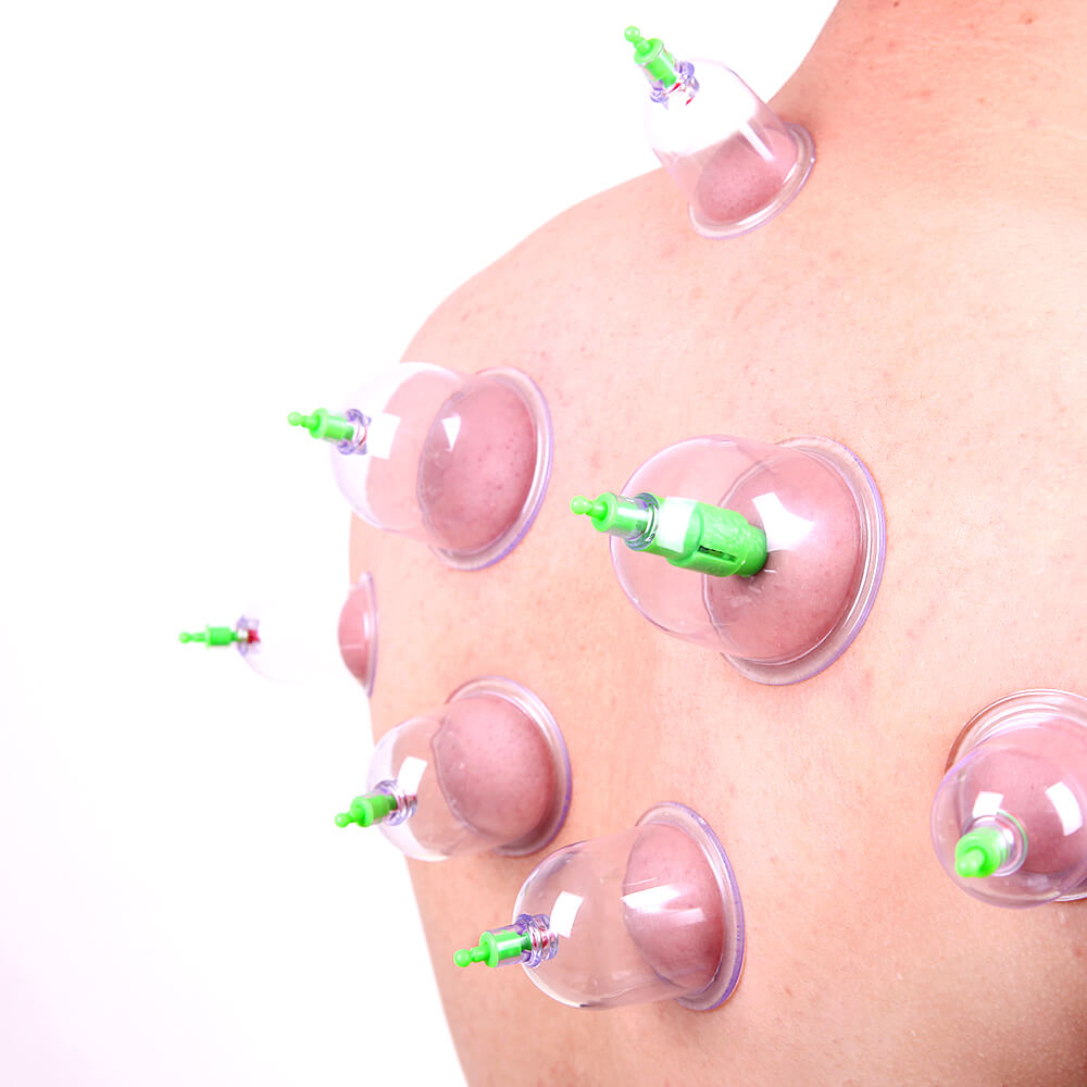 cupping device(图4) cupping device(图4)