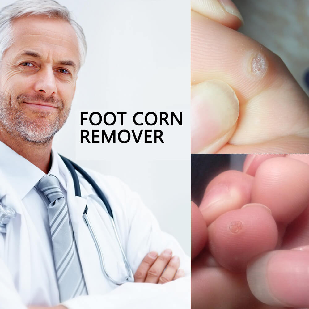 corn plaster corn plaster